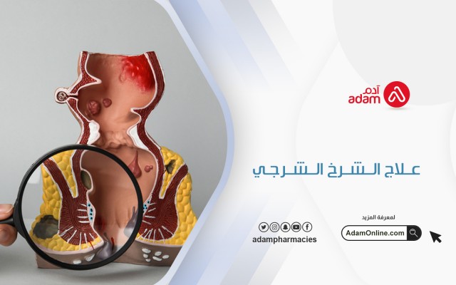 علاج الشرخ الشرجي